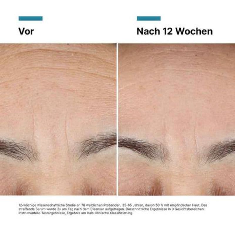Skinceuticals Advanced RGN-6