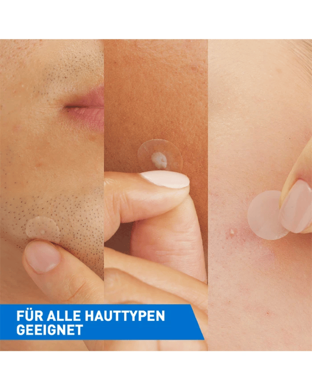 CeraVe Anti-Unreinheiten Patches