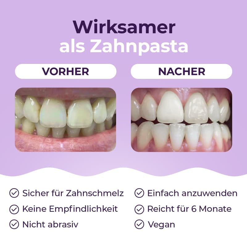 OnlySmile Zahnaufhellungspulver