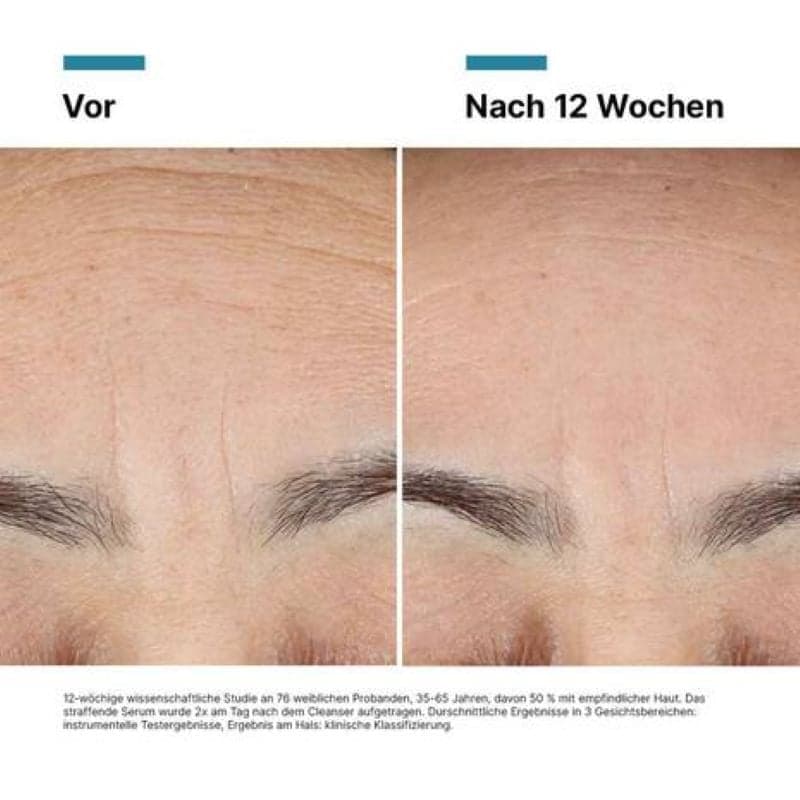 Skinceuticals Advanced RGN-6